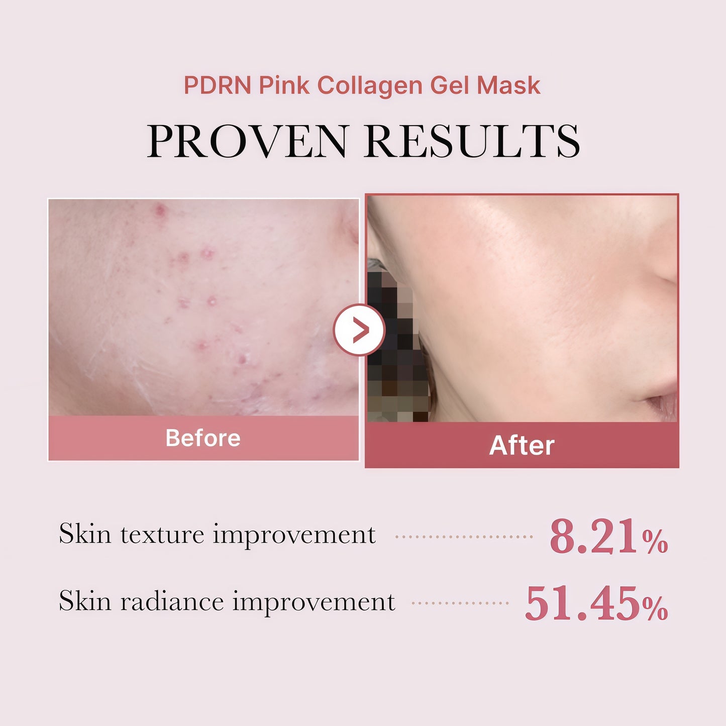 medicube Jelly Gel Mask with Salmon DNA PDRN Pink Collagen, 4EA | Overnight Face Mask for Glass Glow Skin - Elasticity, Hydrating, Firming and Moisturizing, Korean Skincare, 28g x 4ea