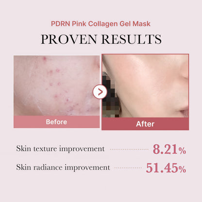 medicube Jelly Gel Mask with Salmon DNA PDRN Pink Collagen, 4EA | Overnight Face Mask for Glass Glow Skin - Elasticity, Hydrating, Firming and Moisturizing, Korean Skincare, 28g x 4ea